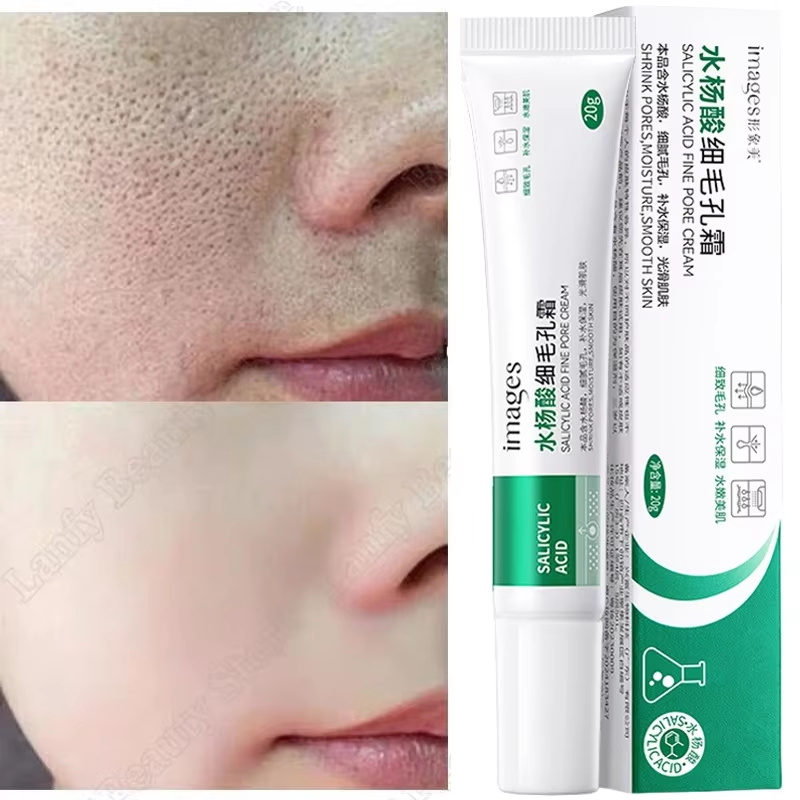 Salicylic Acid Blackhead Remover - Salicylsäure Porenreinigungscreme Verkleinert Poren Entfernt Mitesser