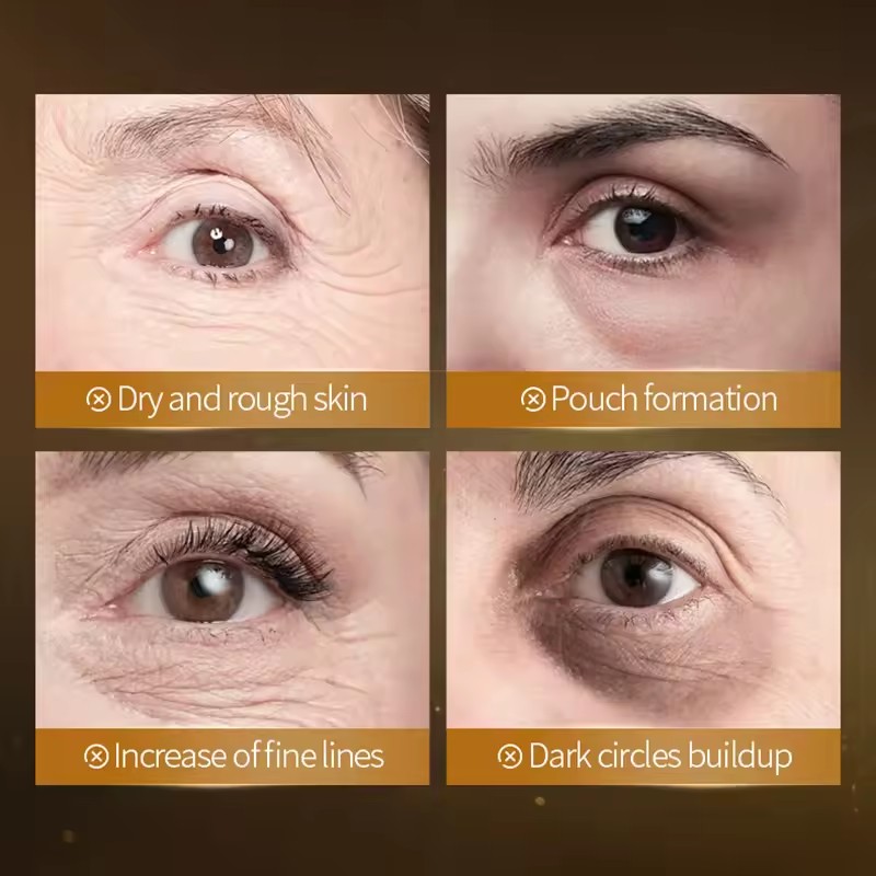 60 Stück SADOER Vitamin C Kris – Collagen Under Eye Patches Bewertung und Preis