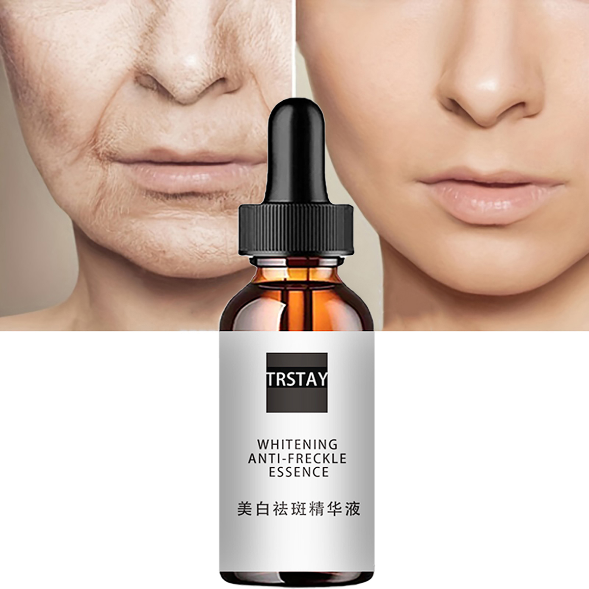 Niacinamid Säure Gesichts Esse – Niacinamide Pore Shrinking Essence Bewertung und Preis