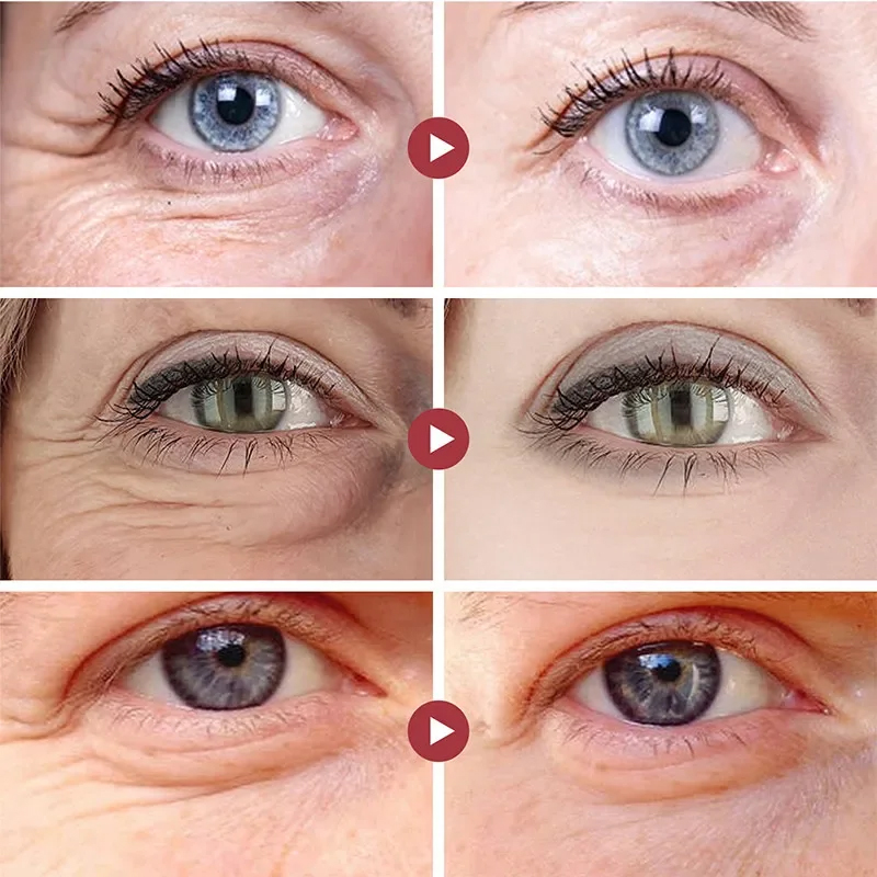 Falten Entfernen Augen Patches – Collagen Under Eye Patches Bewertung und Preis